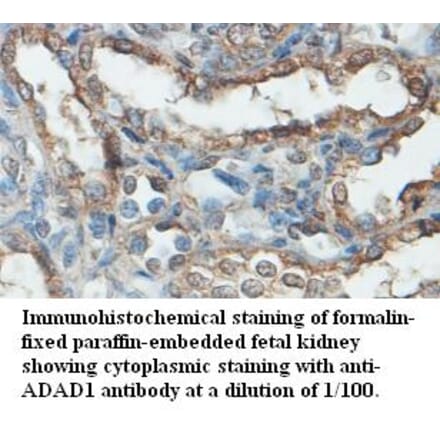 ADAD1 Antibody from Signalway Antibody (39480) - Antibodies.com