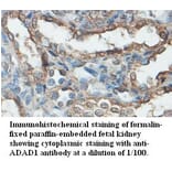 ADAD1 Antibody from Signalway Antibody (39480) - Antibodies.com