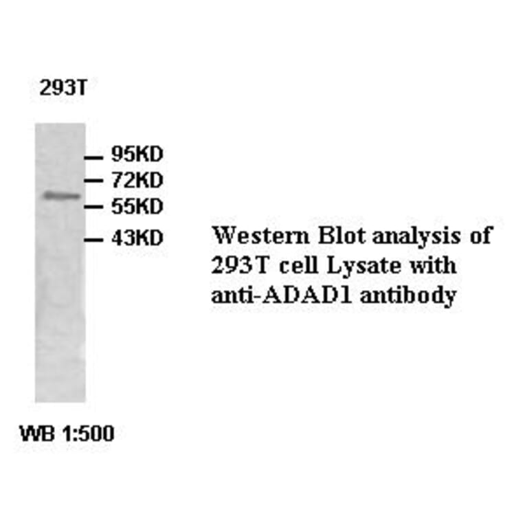 ADAD1 Antibody from Signalway Antibody (39480) - Antibodies.com
