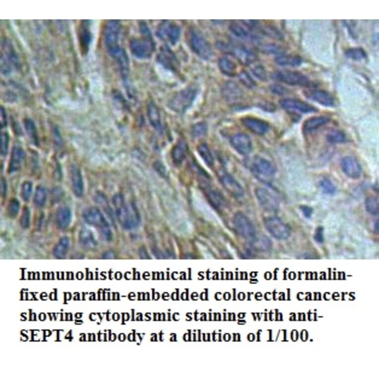 SEPT4 Antibody from Signalway Antibody (39491) - Antibodies.com