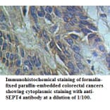 SEPT4 Antibody from Signalway Antibody (39491) - Antibodies.com