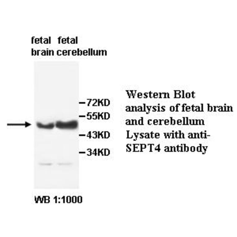 SEPT4 Antibody from Signalway Antibody (39491) - Antibodies.com