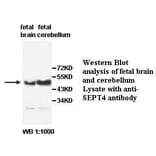 SEPT4 Antibody from Signalway Antibody (39491) - Antibodies.com