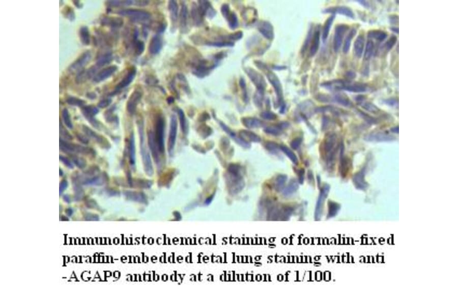 AGAP9 Antibody from Signalway Antibody (39492) - Antibodies.com