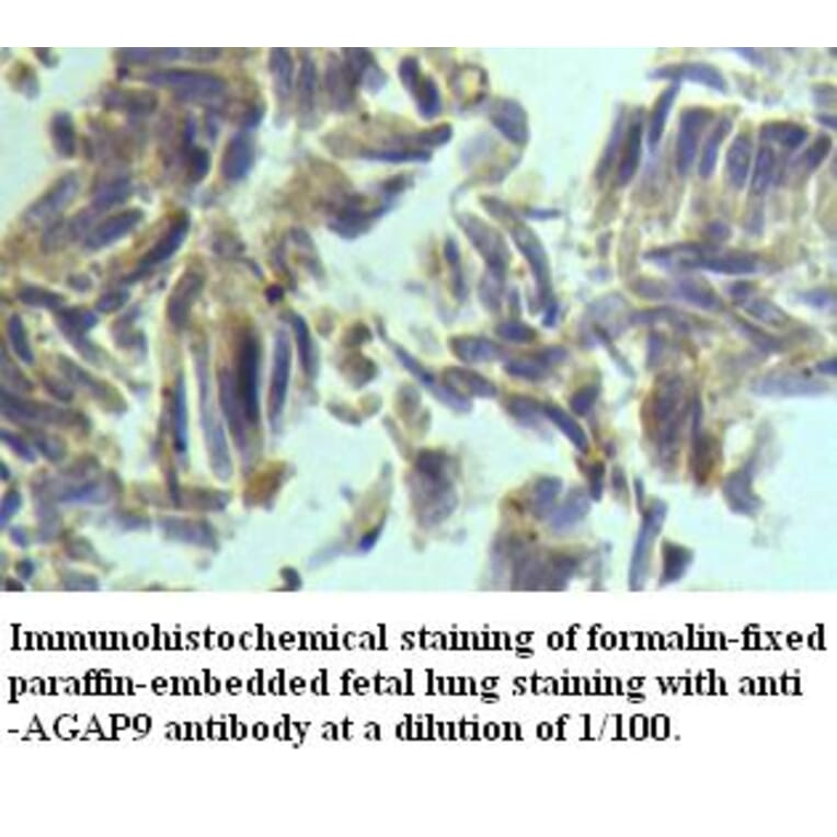 AGAP9 Antibody from Signalway Antibody (39492) - Antibodies.com