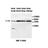 AGAP9 Antibody from Signalway Antibody (39492) - Antibodies.com