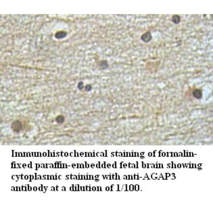 AGAP3 Antibody from Signalway Antibody (39494) - Antibodies.com