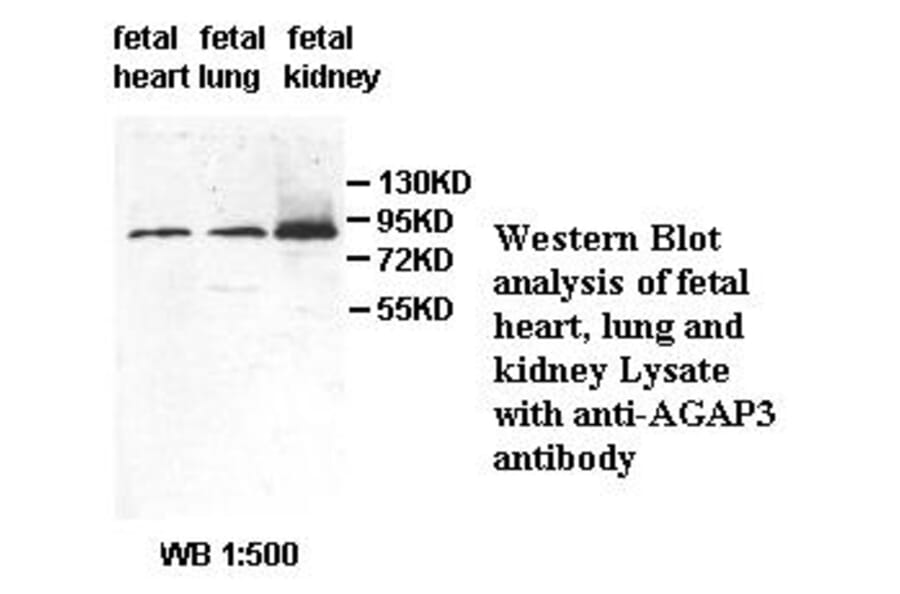 AGAP3 Antibody from Signalway Antibody (39494) - Antibodies.com