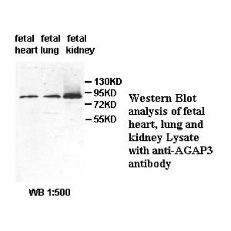 AGAP3 Antibody from Signalway Antibody (39494) - Antibodies.com