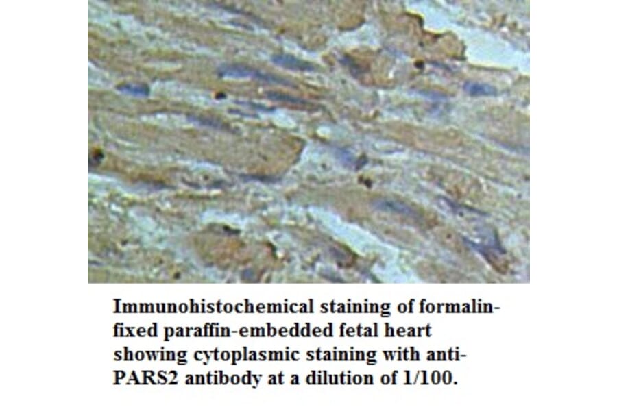 PARS2 Antibody from Signalway Antibody (39506) - Antibodies.com