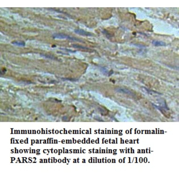 PARS2 Antibody from Signalway Antibody (39506) - Antibodies.com