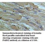 PARS2 Antibody from Signalway Antibody (39506) - Antibodies.com
