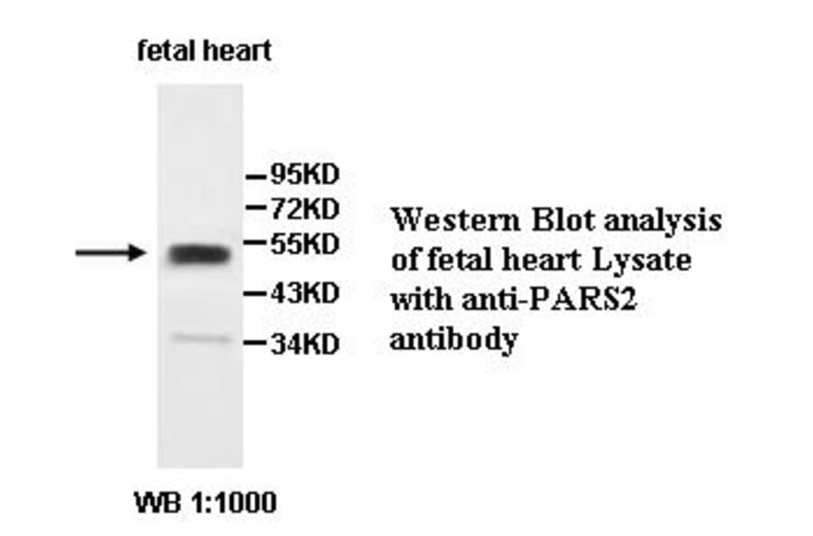 PARS2 Antibody from Signalway Antibody (39506) - Antibodies.com