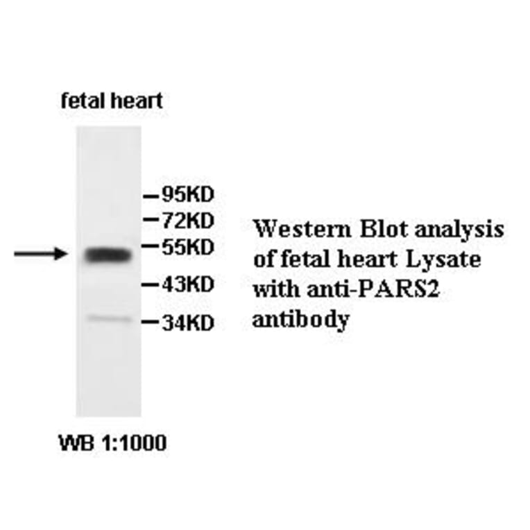PARS2 Antibody from Signalway Antibody (39506) - Antibodies.com