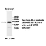 PARS2 Antibody from Signalway Antibody (39506) - Antibodies.com