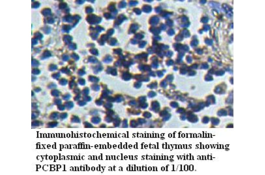 PCBP1 Antibody from Signalway Antibody (39508) - Antibodies.com
