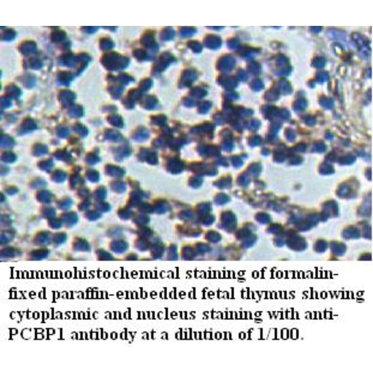 PCBP1 Antibody from Signalway Antibody (39508) - Antibodies.com