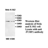 PCBP1 Antibody from Signalway Antibody (39508) - Antibodies.com