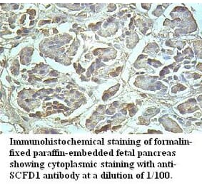 SCFD1 Antibody from Signalway Antibody (39510) - Antibodies.com