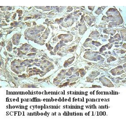 SCFD1 Antibody from Signalway Antibody (39510) - Antibodies.com