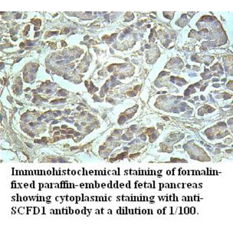 SCFD1 Antibody from Signalway Antibody (39510) - Antibodies.com