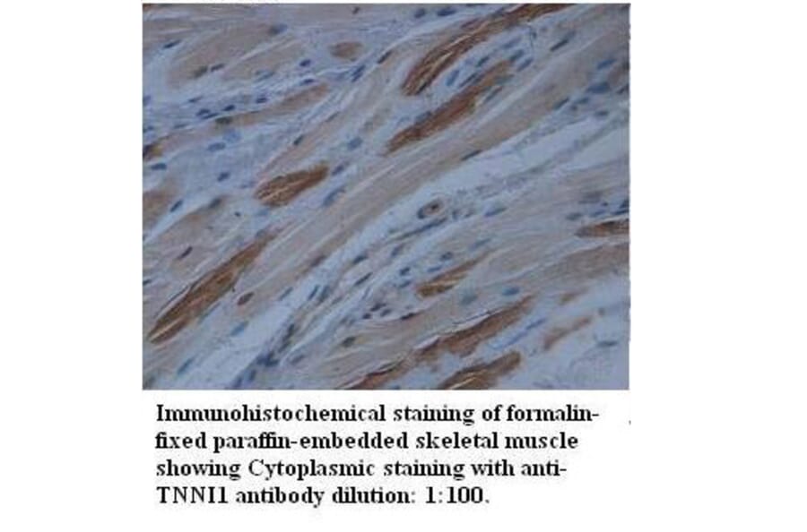 TNNI1 Antibody from Signalway Antibody (39512) - Antibodies.com