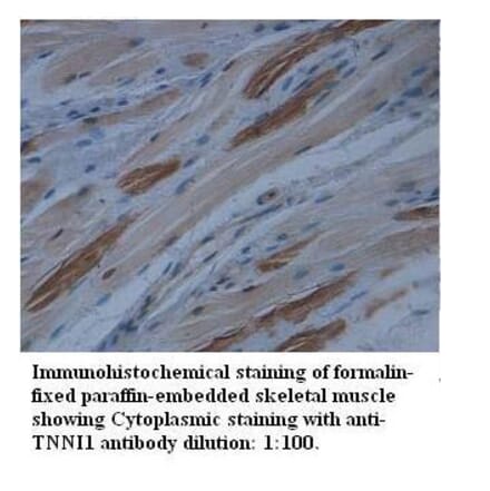 TNNI1 Antibody from Signalway Antibody (39512) - Antibodies.com