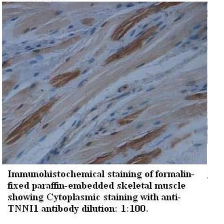 TNNI1 Antibody from Signalway Antibody (39512) - Antibodies.com