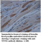 TNNI1 Antibody from Signalway Antibody (39512) - Antibodies.com