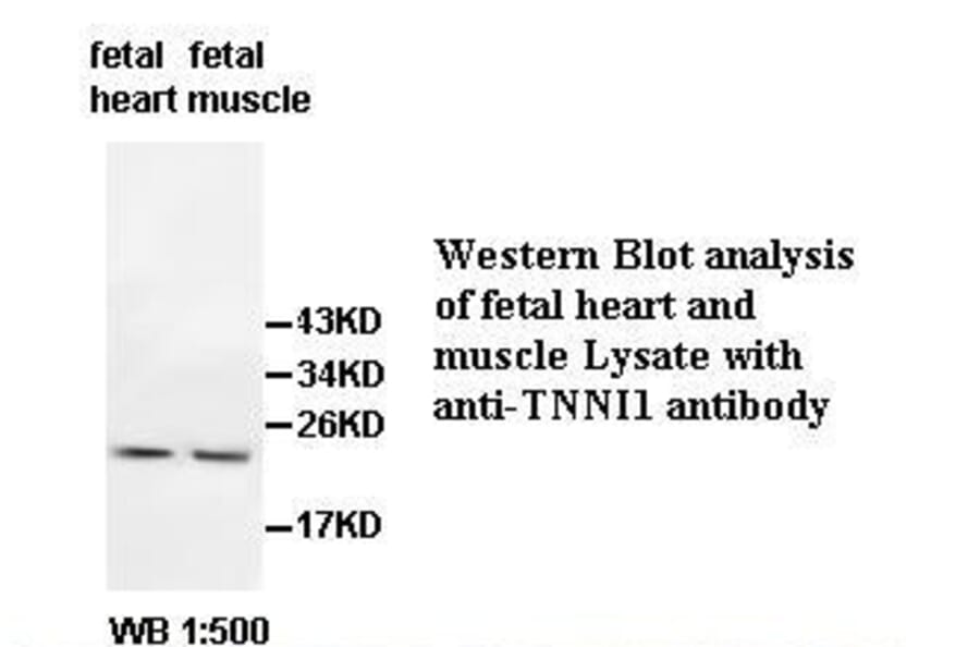 TNNI1 Antibody from Signalway Antibody (39512) - Antibodies.com