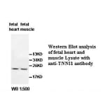 TNNI1 Antibody from Signalway Antibody (39512) - Antibodies.com