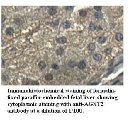 AGXT2 Antibody from Signalway Antibody (39516) - Antibodies.com