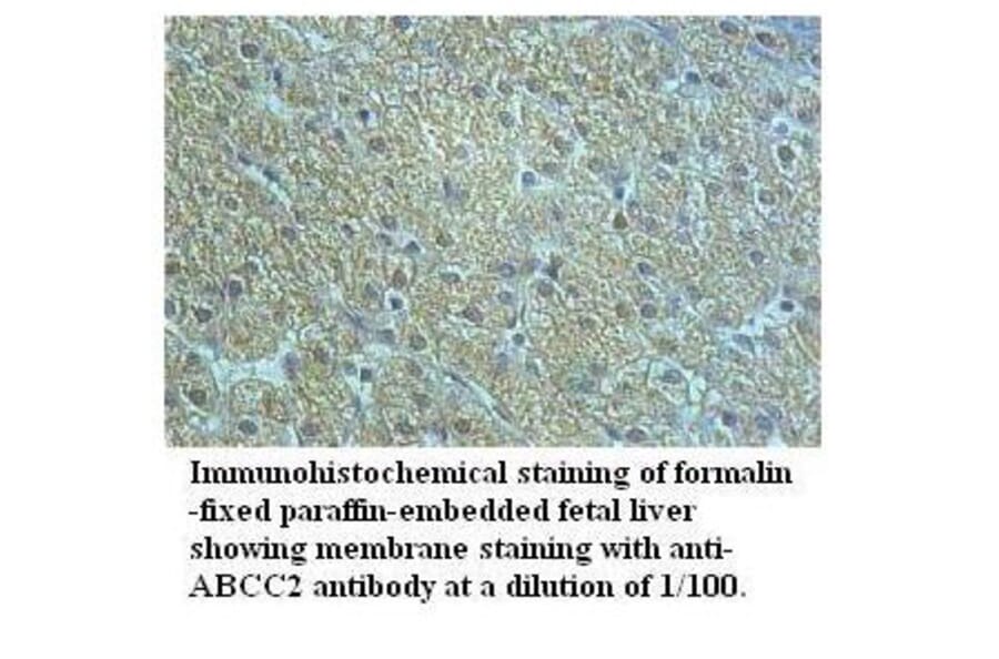 ABCC2 Antibody from Signalway Antibody (39518) - Antibodies.com