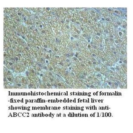 ABCC2 Antibody from Signalway Antibody (39518) - Antibodies.com