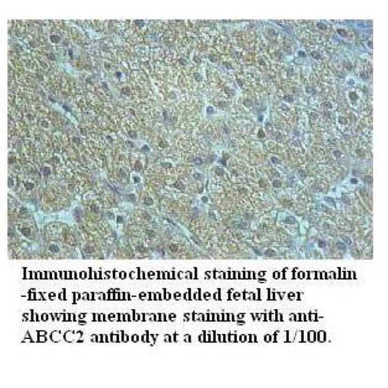 ABCC2 Antibody from Signalway Antibody (39518) - Antibodies.com