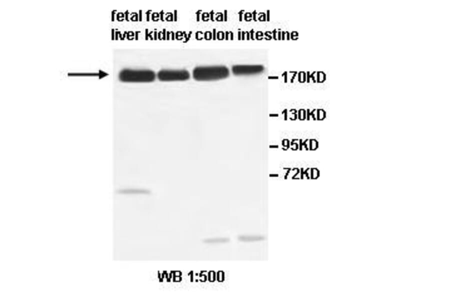 ABCC2 Antibody from Signalway Antibody (39518) - Antibodies.com