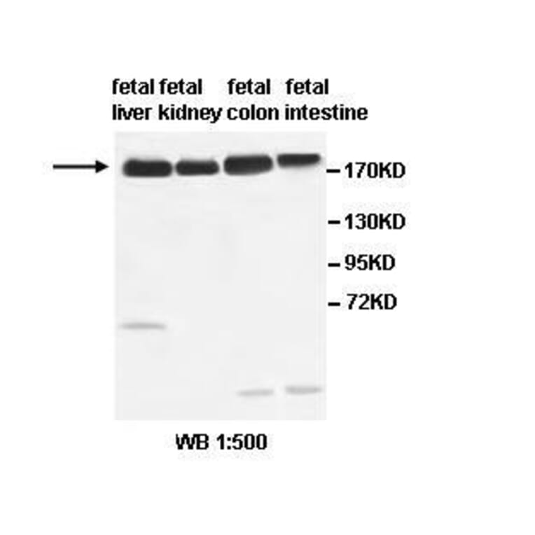 ABCC2 Antibody from Signalway Antibody (39518) - Antibodies.com