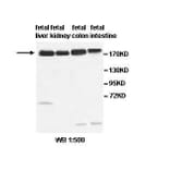 ABCC2 Antibody from Signalway Antibody (39518) - Antibodies.com