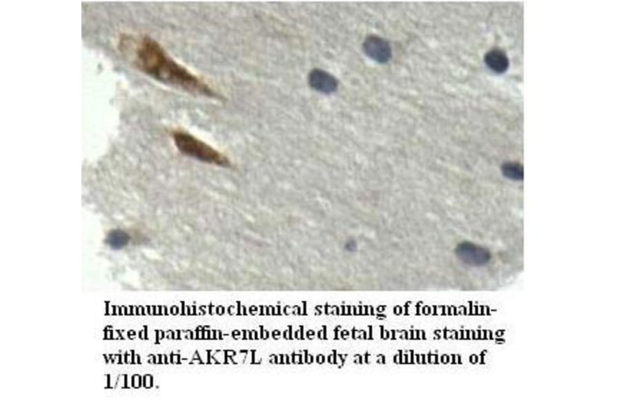 AKR7L Antibody from Signalway Antibody (39520) - Antibodies.com