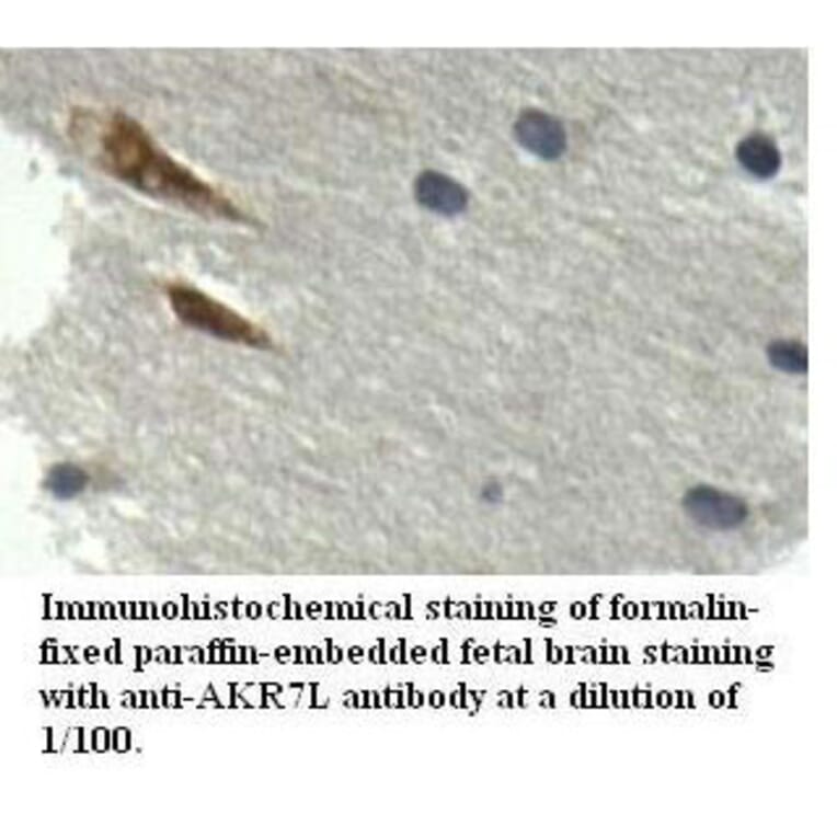 AKR7L Antibody from Signalway Antibody (39520) - Antibodies.com