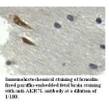 AKR7L Antibody from Signalway Antibody (39520) - Antibodies.com