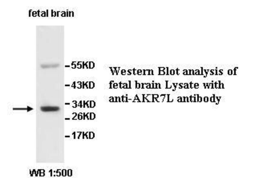 AKR7L Antibody from Signalway Antibody (39520) - Antibodies.com