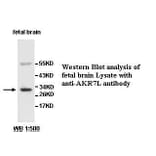 AKR7L Antibody from Signalway Antibody (39520) - Antibodies.com