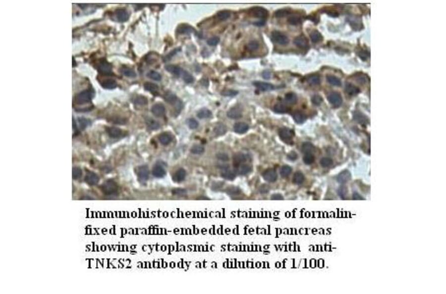 TNKS2 Antibody from Signalway Antibody (39522) - Antibodies.com