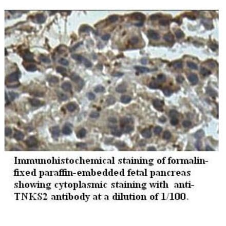 TNKS2 Antibody from Signalway Antibody (39522) - Antibodies.com