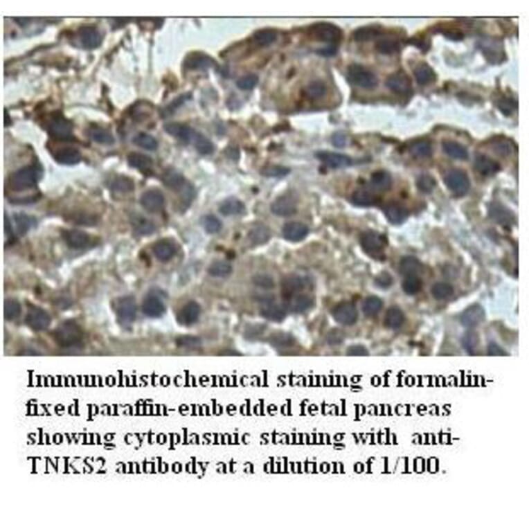TNKS2 Antibody from Signalway Antibody (39522) - Antibodies.com