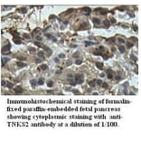 TNKS2 Antibody from Signalway Antibody (39522) - Antibodies.com
