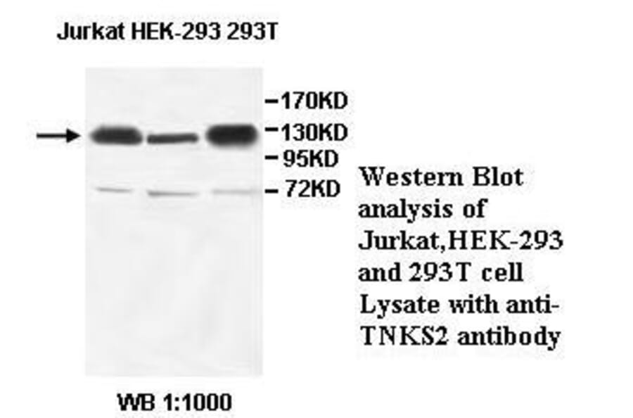TNKS2 Antibody from Signalway Antibody (39522) - Antibodies.com