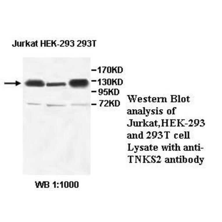 TNKS2 Antibody from Signalway Antibody (39522) - Antibodies.com