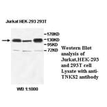 TNKS2 Antibody from Signalway Antibody (39522) - Antibodies.com